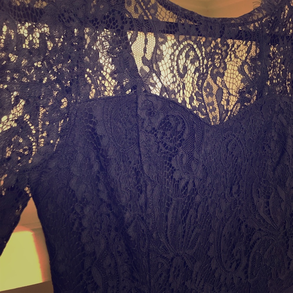 Royal blue lace dress👗